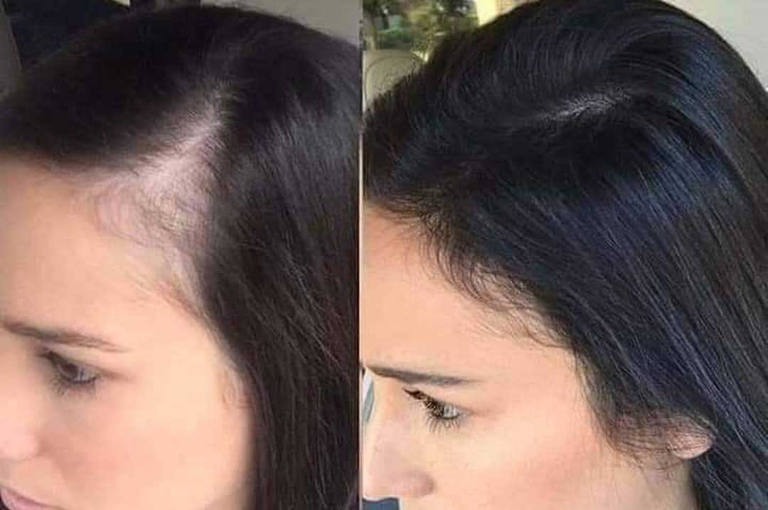 tonico-de-gengibre-antes-e-depois