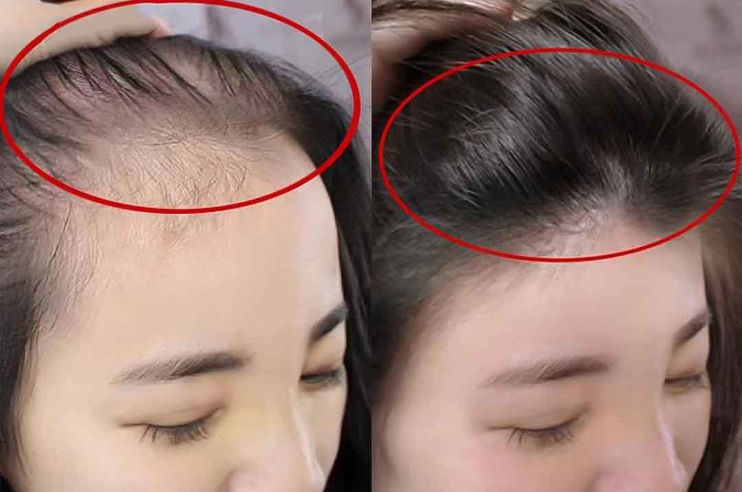 tonico-de-gengibre-antes-e-depois.jpg