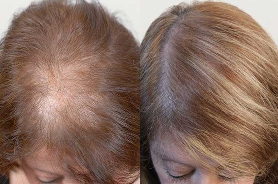 tonico-de-gengibre-antes-e-depois2
