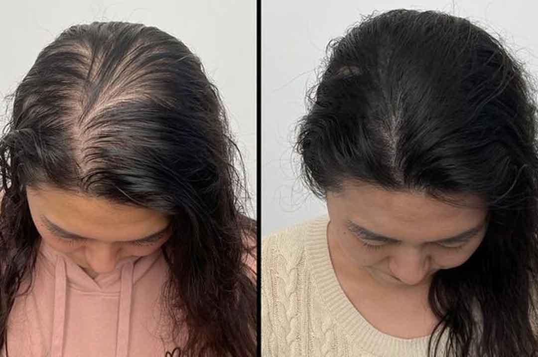 tonico-de-gengibre-antes-e-depois4.jpg